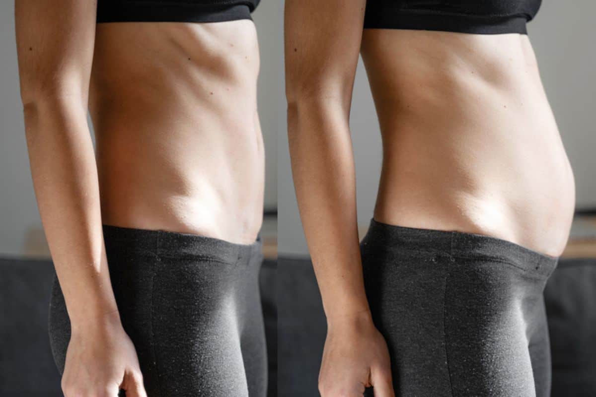How long does diastasis recti take to improve Durham?