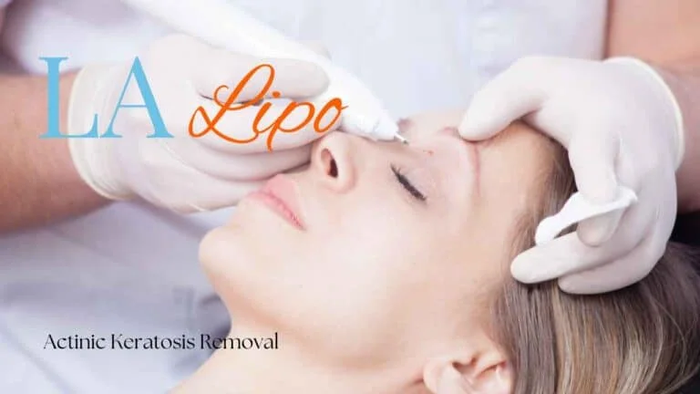 Woman receiving Actinic Keratosis Removal Treatment Durham