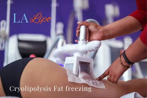 women getting fat freezing Durham