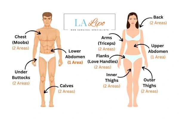 LA LIPO Cryolipolysis Areas Durham