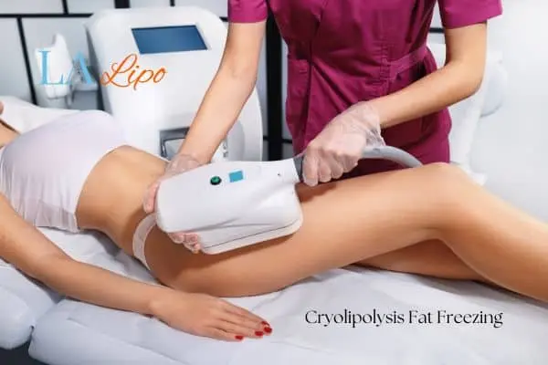 Woman receiving coolsculpting Durham treatment on her thighs