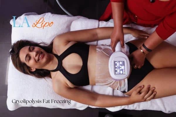 woman getting cryolipolysis Durham