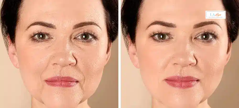 How Long Does It Take to See Results and How Long Do They Last Durham?