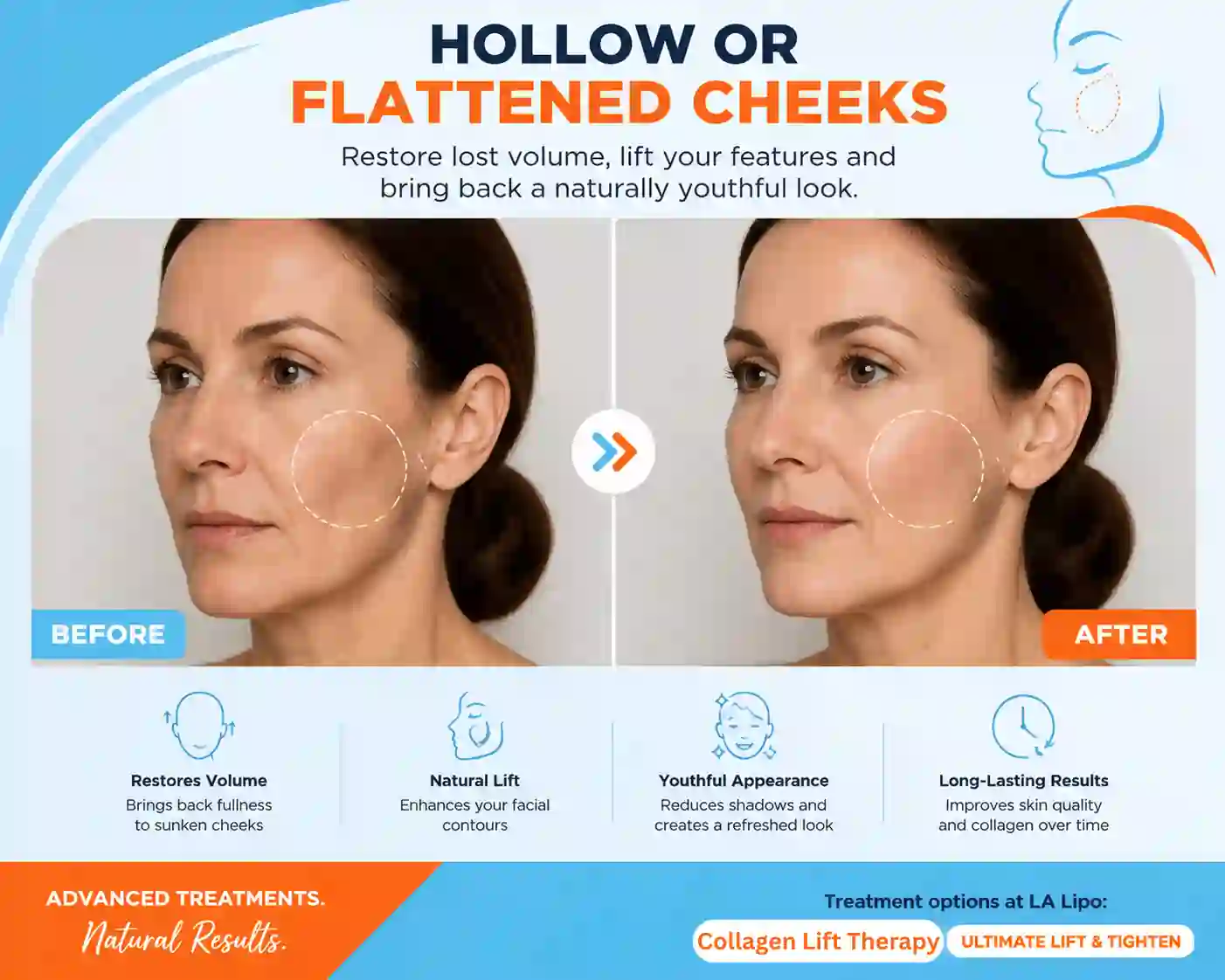 Sign #4: Hollow or Flattened Cheeks Durham