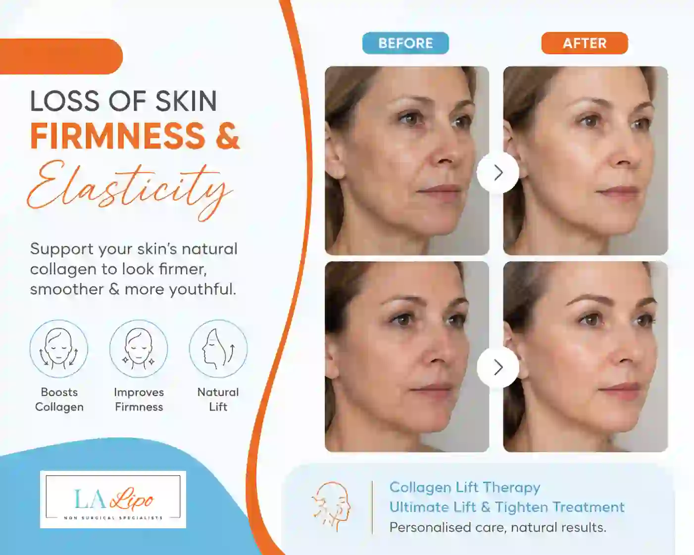 Sign #7: Loss of Skin Firmness and Elasticity Durham